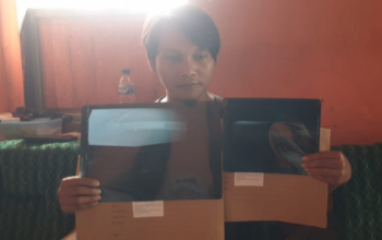 Dugaan Penganiayaan Mantan Napi Lapas Kelas IIA Kediri Resmi Dilaporkan ke Polda Jatim