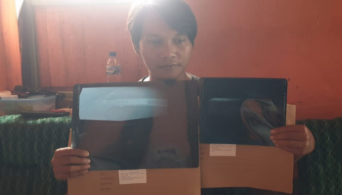 Dugaan Penganiayaan Mantan Napi Lapas Kelas IIA Kediri Resmi Dilaporkan ke Polda Jatim