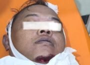Diduga Terpeleset, Peserta Tiban di Binangun Meninggal Dunia