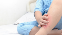 Ini Rahasia Mengejutkan! Alergi Anak Bisa Hilang Saat Dewasa?