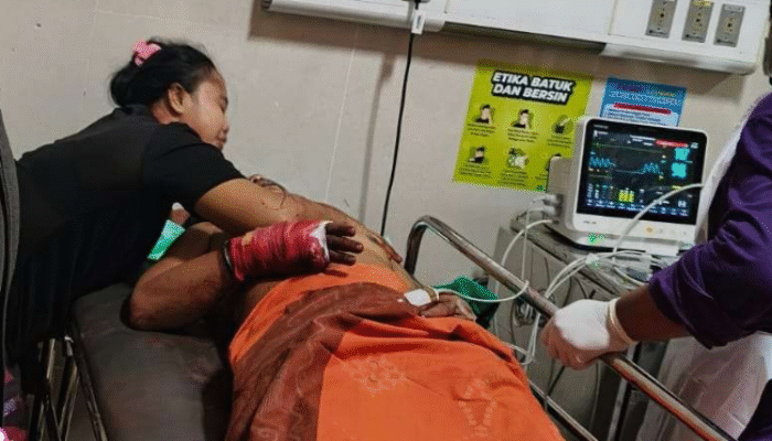 Jurnalis di Sampang Dibacok Dua Pria, Alami Luka Serius