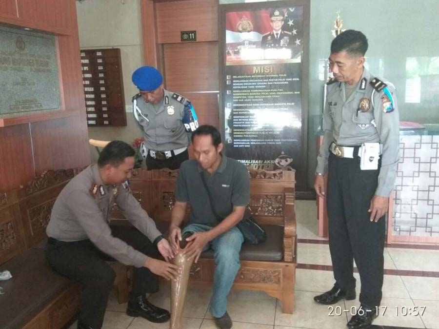 Bantuan Kaki Palsu