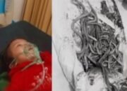 Cacing Keluar dari Hidung Balita, Kisah Tragis yang Menyoroti Sanitasi dan Penyakit di Daerah Terpencil