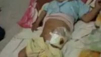 Bayi Tanpa Anus Lahir Dari Orang Kurang Mampu