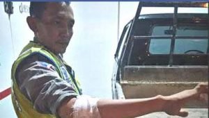 Crass !  Polisi Patroli Disabet Pedang Hingga Berlumuran Darah