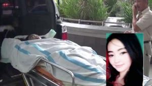 Muka Purel Cantik Mlepuh, Dipastikan Cacat,  Hari Ini Dioperasi di RS Dr Sutomo