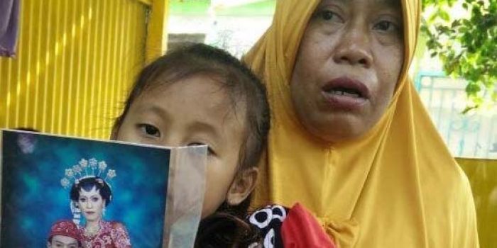 TKW Malaysia Asal Pasuruan Wajahnya Tersiram Bahan Kimia Hingga Melepuh, Ini Jeritan Ibunya..