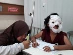 Wajah Gadis Ini Dicelupkan Minyak Panas Oleh Nenek Tirinya, Ini Kronologisnya